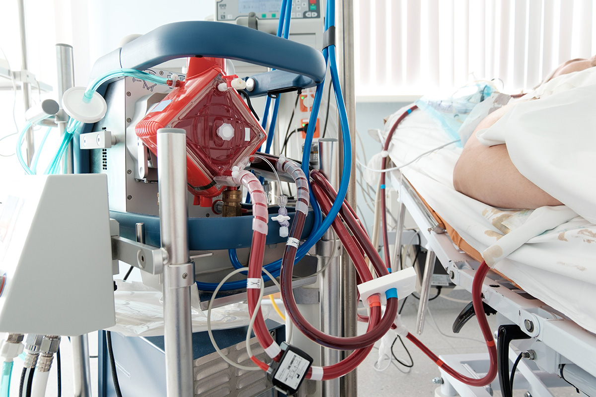 Should you be Scavenging on COVID-19 ECMO patients? - Blog