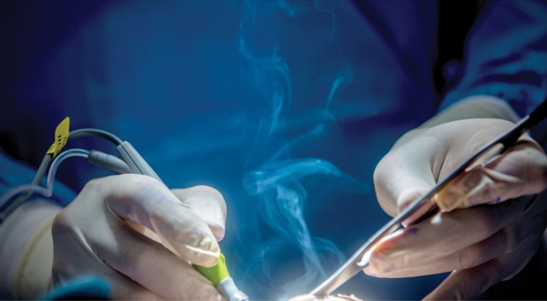 Cost-effective and versatile solutions for surgical smoke evacuation - Blog